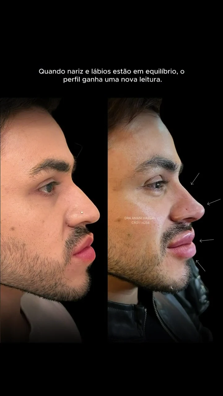 Comparativo de perfil de outro paciente, conforme o material original